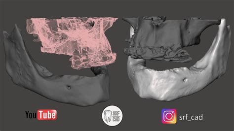 convertire file dicom in stl.
